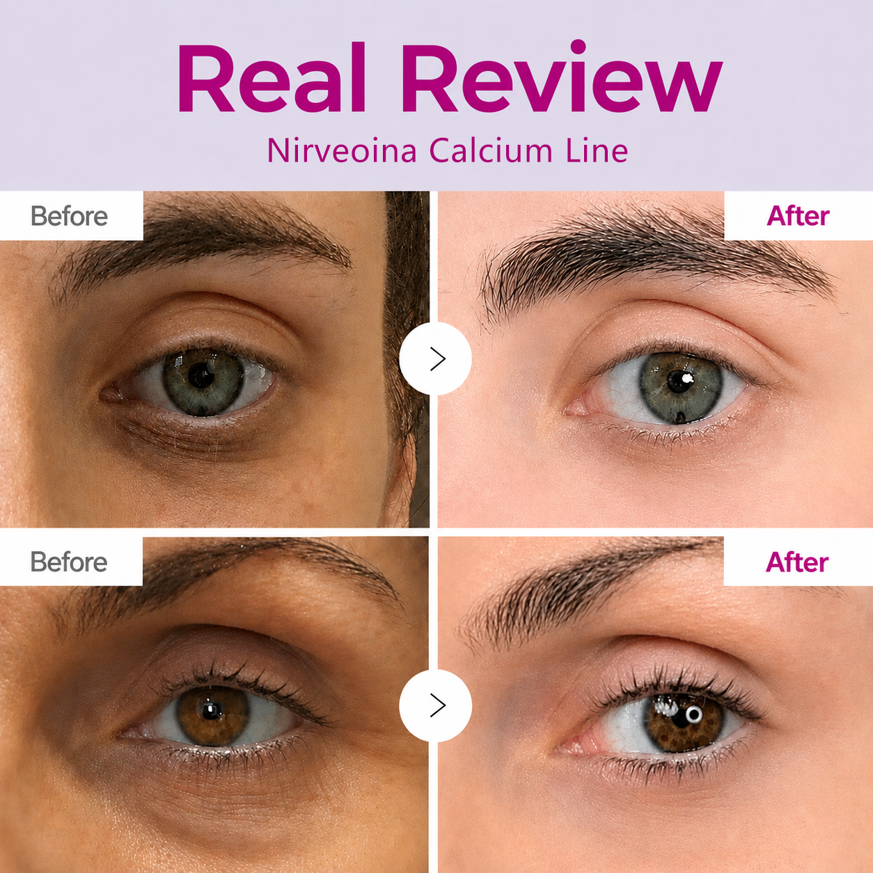 🔥LAST DAY 50% OFF!!Nirveoina Korean Calcium Dark Spot Eye Cream